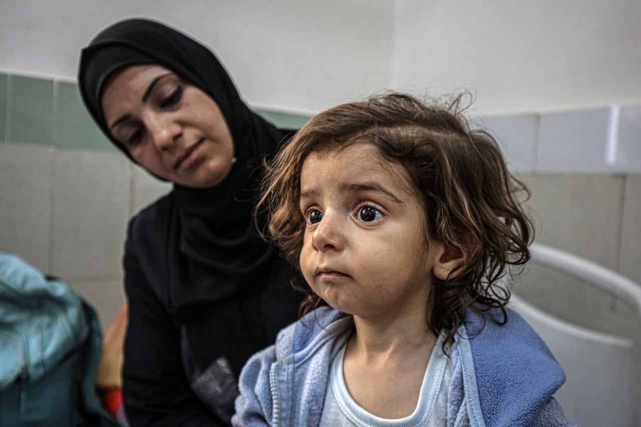 Jihad Saad sits at the Al-Rantisi Children's Hospital in Gaza City, on May 4. Saad is one of dozens of children inside the hospital suffering from severe malnutrition due to Israel's total blockade of food and aid.