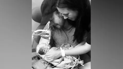 Emmie Studencki/Ryan Parker A black and white, portrait image of a newborn baby, Quinn Lias Parker, in the arms of his parents. His dad is wearing a striped t-shirt and cap, sitting in a chair. His mum is leaning over him with only her head and arm in the frame. Quinn Parker has numerous wires attached to his body. 