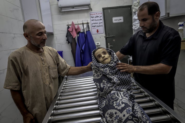 The body of a Palestinian girl who died from severe malnutrition is brought to Al-Shifa Hospital for funeral processing, in Gaza City, Gaza on Wednesday.