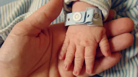 Getty Images Newborn baby's hand, with a hospital identification wristband round it, being held by their mother