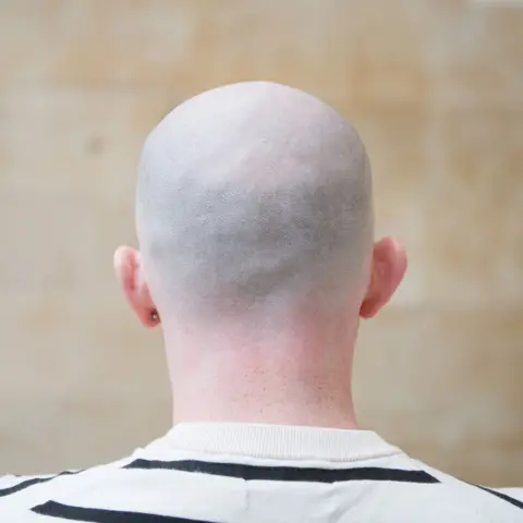 Ian Casey's head from behind