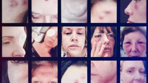 A montage of close-up photographs showing women with visible injuries and swelling around their eyes and faces, including bruising, drooping eyelids and red marks