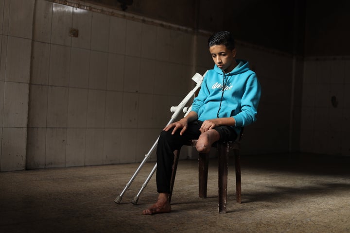 Fourteen-year-old Yamen Asfur, who lives in the Daraj neighborhood, was injured after the Israeli army targeted his family home during the war, in Gaza City, Gaza, on February 02, 2026. (Photo by Khames Alrefi/Anadolu via Getty Images)