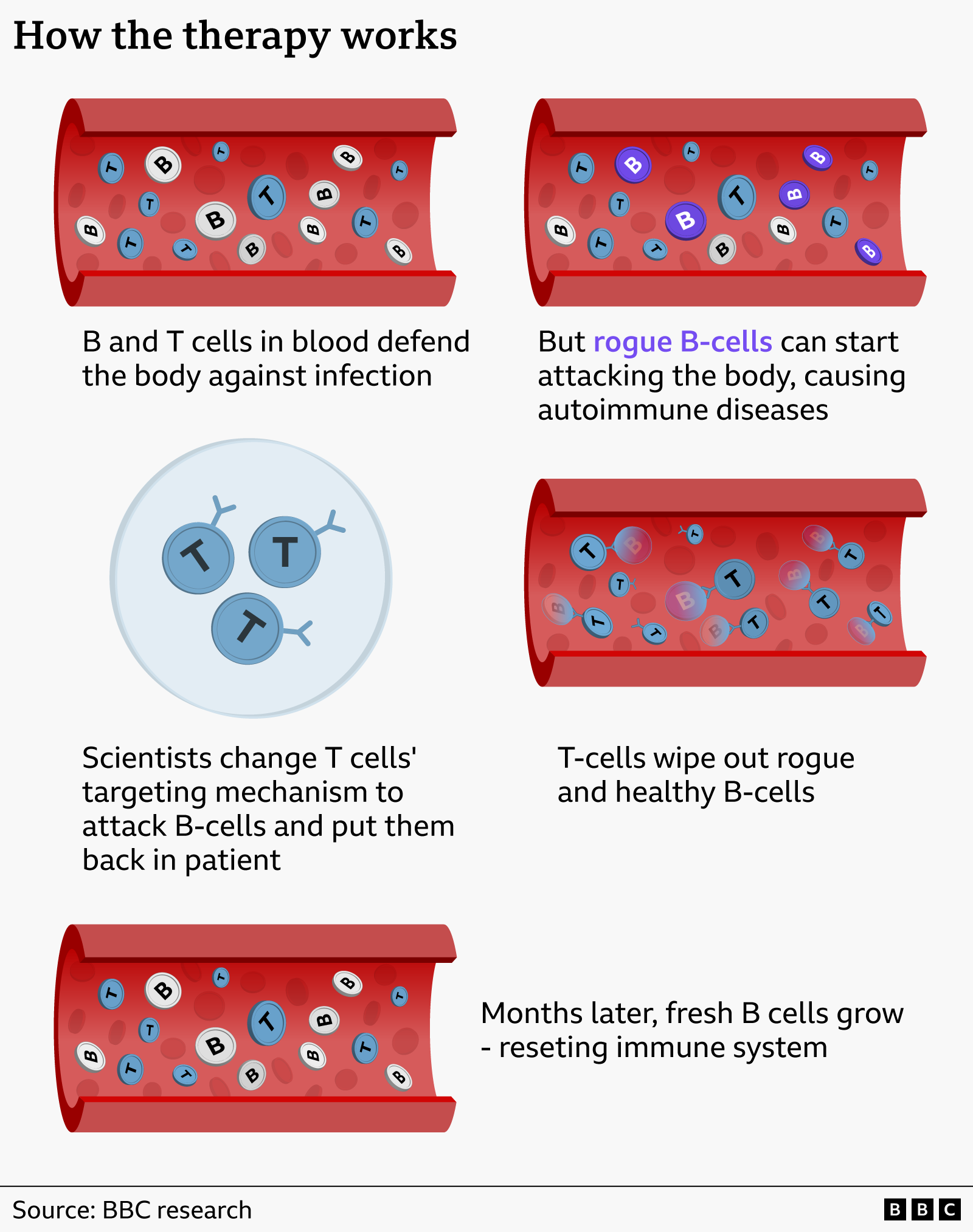 The graphic titled “How the therapy works” is a multi-panel medical illustration showing a step-by-step process inside blood vessels, using red cylindrical tube shapes to represent the bloodstream and circular icons labelled “B” and “T” to represent B cells and T cells. In the top-left panel, blue T cells and grey B cells are shown circulating together with the caption, “B and T cells in blood defend the body against infection,” establishing the normal immune system function. In the top-right panel, some B cells are highlighted in purple to indicate “rogue B-cells,” accompanied by text explaining that these abnormal cells can attack the body and cause autoimmune disease. The middle section shows a simplified lab-like circle containing T cells, alongside the text “Scientists change T cells' targeting mechanism to attack B-cells and put them back in patient,” indicating that T cells are engineered to target all B cells. In the next panel, modified T cells are shown destroying both normal and rogue B cells inside the bloodstream, with the caption “T-cells wipe out rogue and healthy B-cells.” Finally, the bottom panel shows the bloodstream repopulated with new B cells and T cells, with the text “Months later, fresh B cells grow – resetting immune system,” illustrating recovery and immune system reset, and a small note at the bottom credits “Source: BBC research” along with a BBC logo.