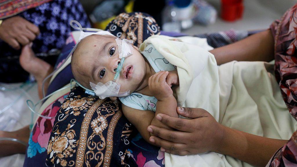 A child looks at the camera, lying on a woman's lap, with tubes inserted into his nose.