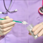 At-home cervical screenings to roll out in city
